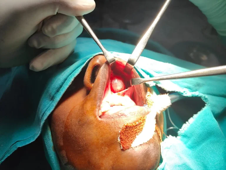 Best ENT Doctor In kolkata 