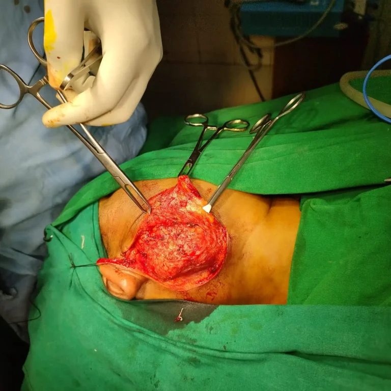 Best ENT Doctor In kolkata 
